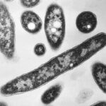 Death toll from Legionnaires’ disease outbreak in New York City rises to 7 and infections hit 114